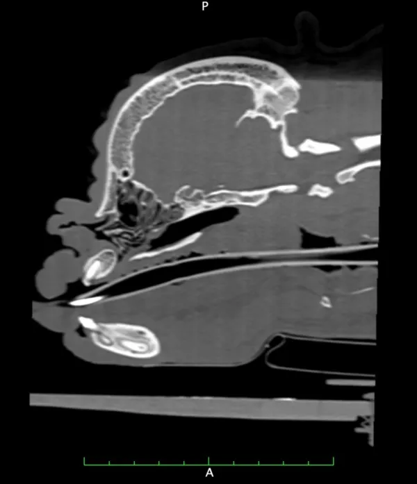 Saggital BOAS skull